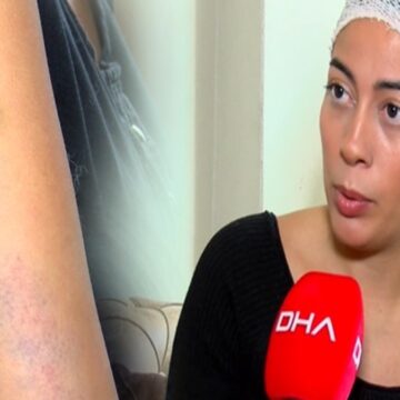 Miras tartışmasında dehşet: Demir çubukla dövdü