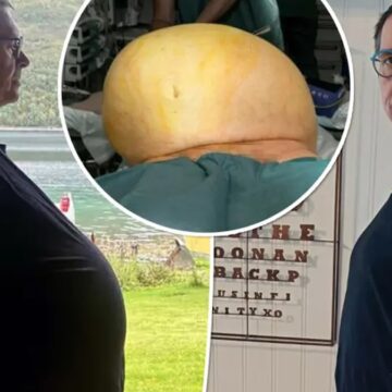 Yıllarca ‘şişmansın zayıfla’ dediler… Sebebi farklı çıktı herkese dava açtı