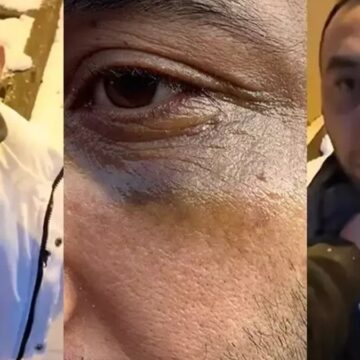 İstanbul’da eski sevgiliye yeni sevgili tuzağı…  Yaşadığı dehşeti anlattı