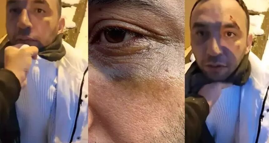 İstanbul’da eski sevgiliye yeni sevgili tuzağı…  Yaşadığı dehşeti anlattı