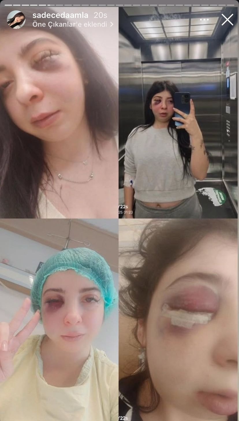 Sokak ortasında tacize uğradı, darp edilen Damla isyan etti!