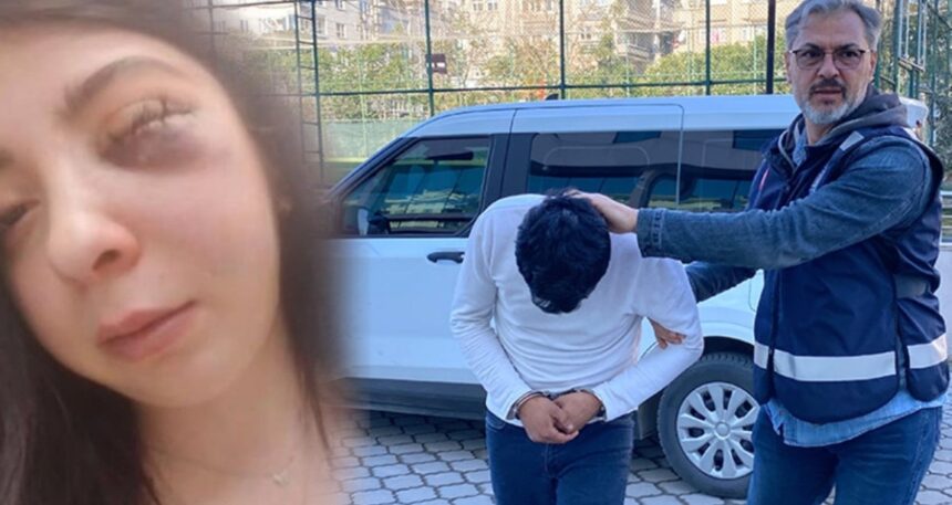 Sokak ortasında tacize uğradı, darp edilen Damla isyan etti!