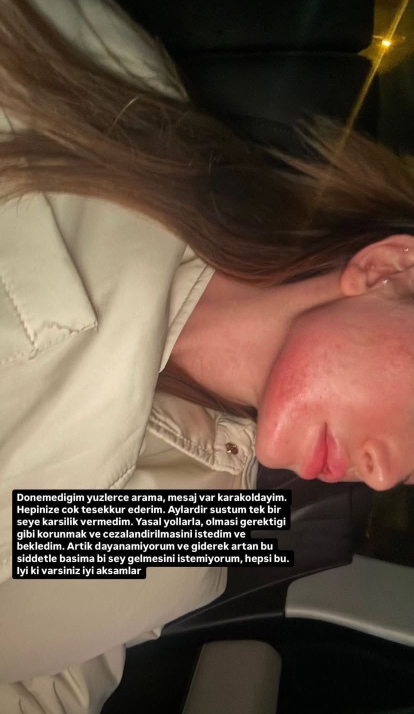 Eski sevgiliden Danla Bilic'e saldırı! Görüntüler ortaya çıktı