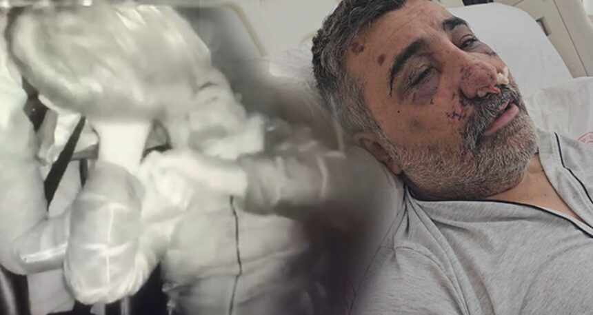 İngiliz boksörün öldüresiye dövdüğü taksici ilk kez konuştu! ‘Neden yaptığını anlamadım, beni öpmeye ve ısırmaya başladı’