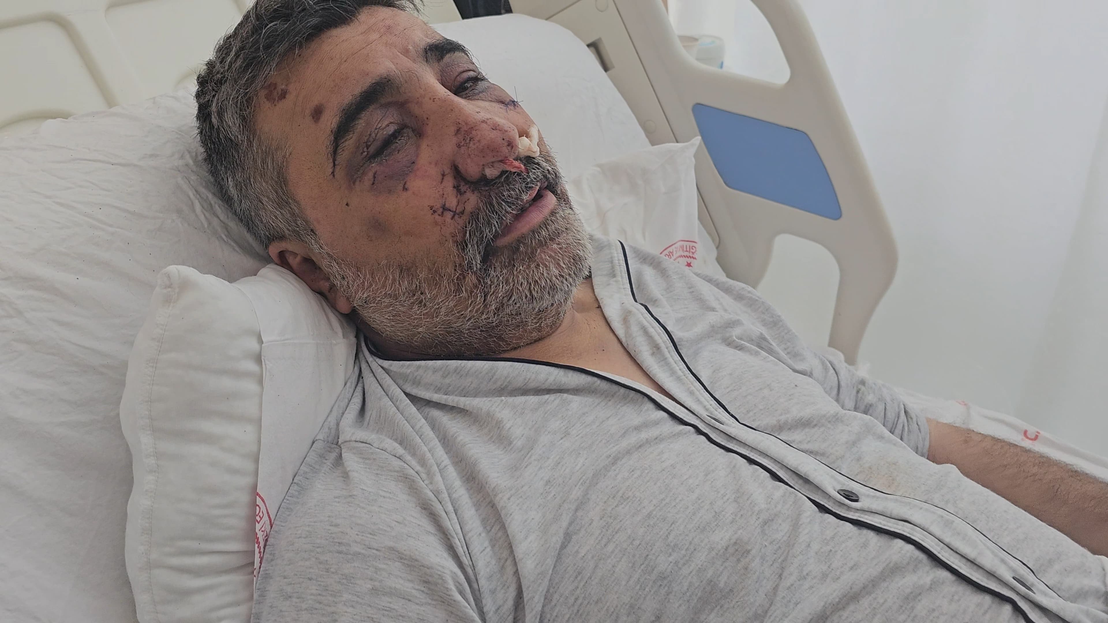 İngiliz boksörün öldüresiye dövdüğü taksici ilk kez konuştu! 'Neden yaptığını anlamadım, beni öpmeye ve ısırmaya başladı'