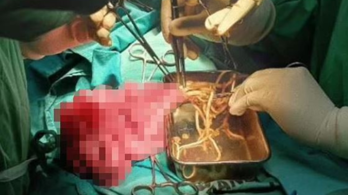 Karnı şişen 3 yaşındaki çocuk ağız dolusu kusunca gerçeği öğrendiler