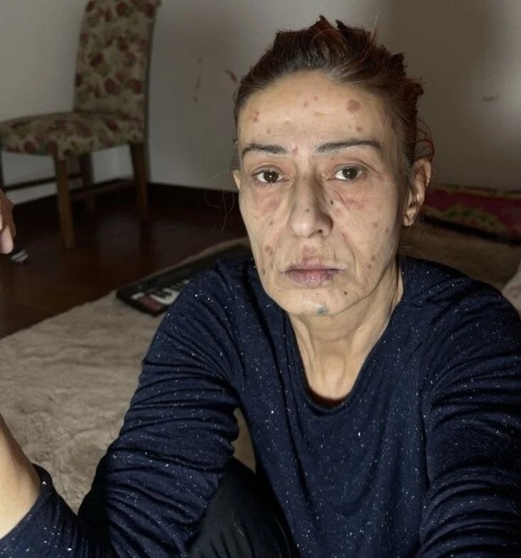 Yıldız Tilbe'den kökten çözüm