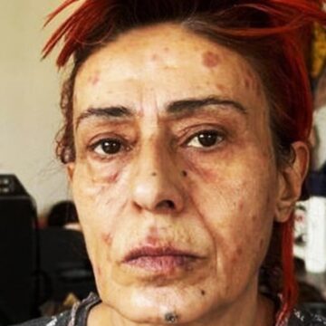 Yıldız Tilbe’den kökten çözüm