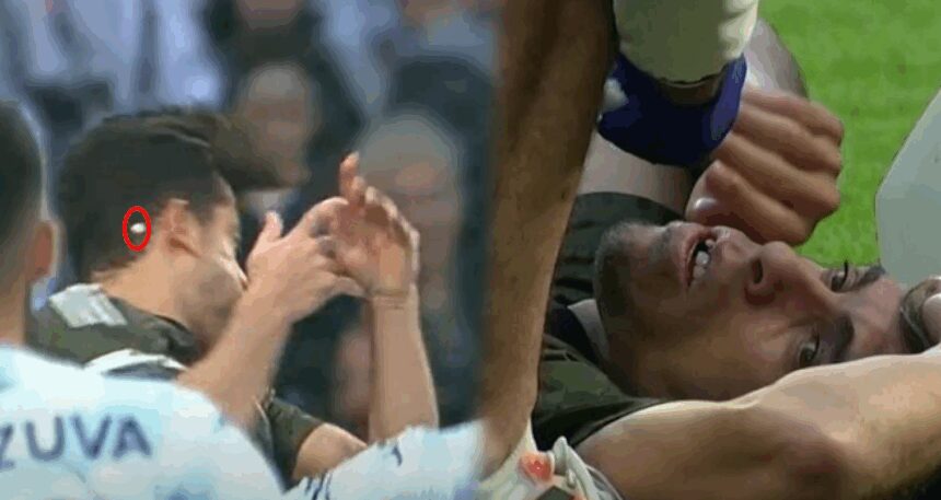 20 dakikada 4 sakatlık! Dişi kırıldı, havada süzüldü
