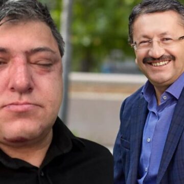 Akılalmaz iddia… Buraya kadar geldik mi? Belediye başkanı ve yardımcıları işçi dövdü