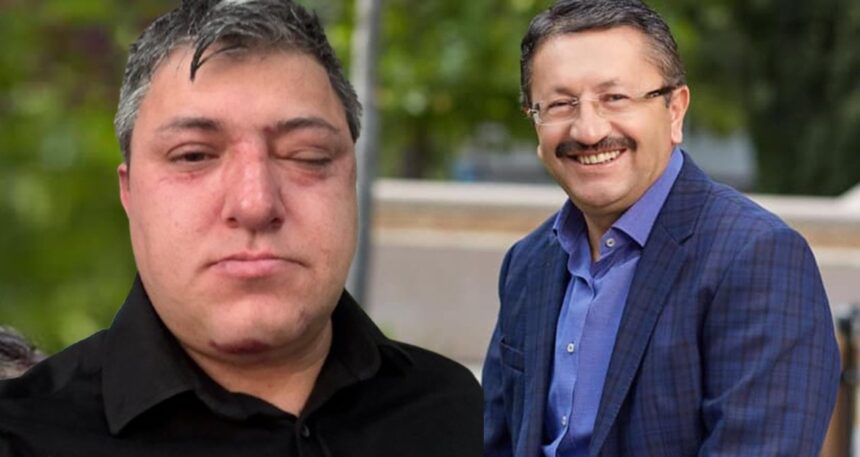 Akılalmaz iddia… Buraya kadar geldik mi? Belediye başkanı ve yardımcıları işçi dövdü