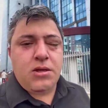 AKP’li ‘belediye yöneticileri işçi darp etti’ iddiası
