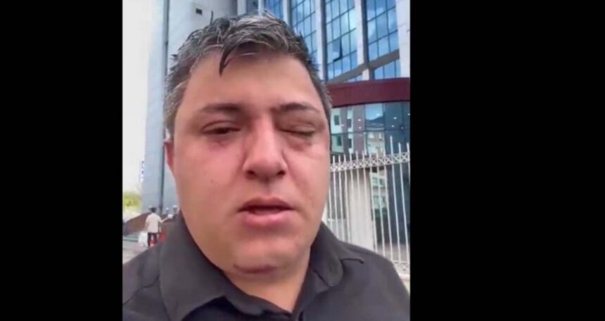 AKP’li ‘belediye yöneticileri işçi darp etti’ iddiası