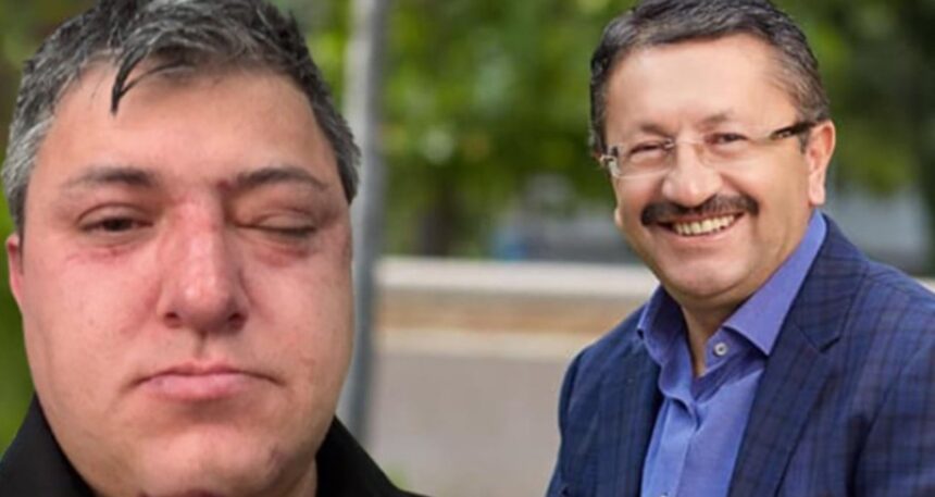 Altındağ Belediyesi personelinin darbedilmesine ilişkin soruşturmada zabıta müdürü tutuklandı!
