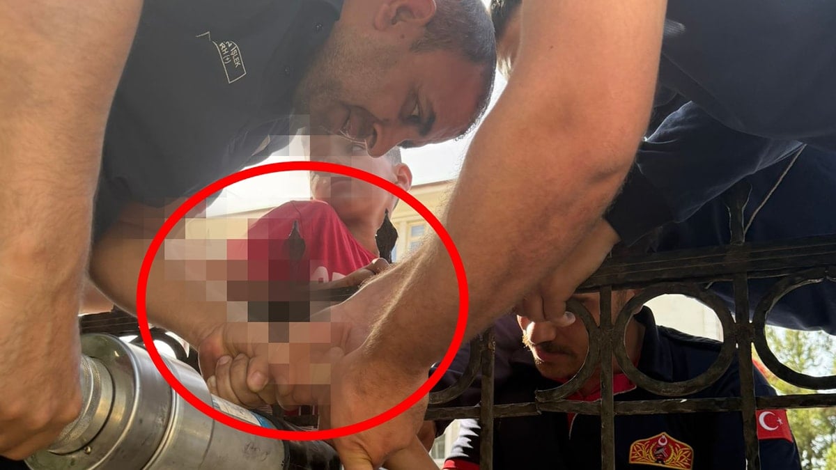 Dut yemek isteyen çocuğun eli korkuluk demirine saplandı