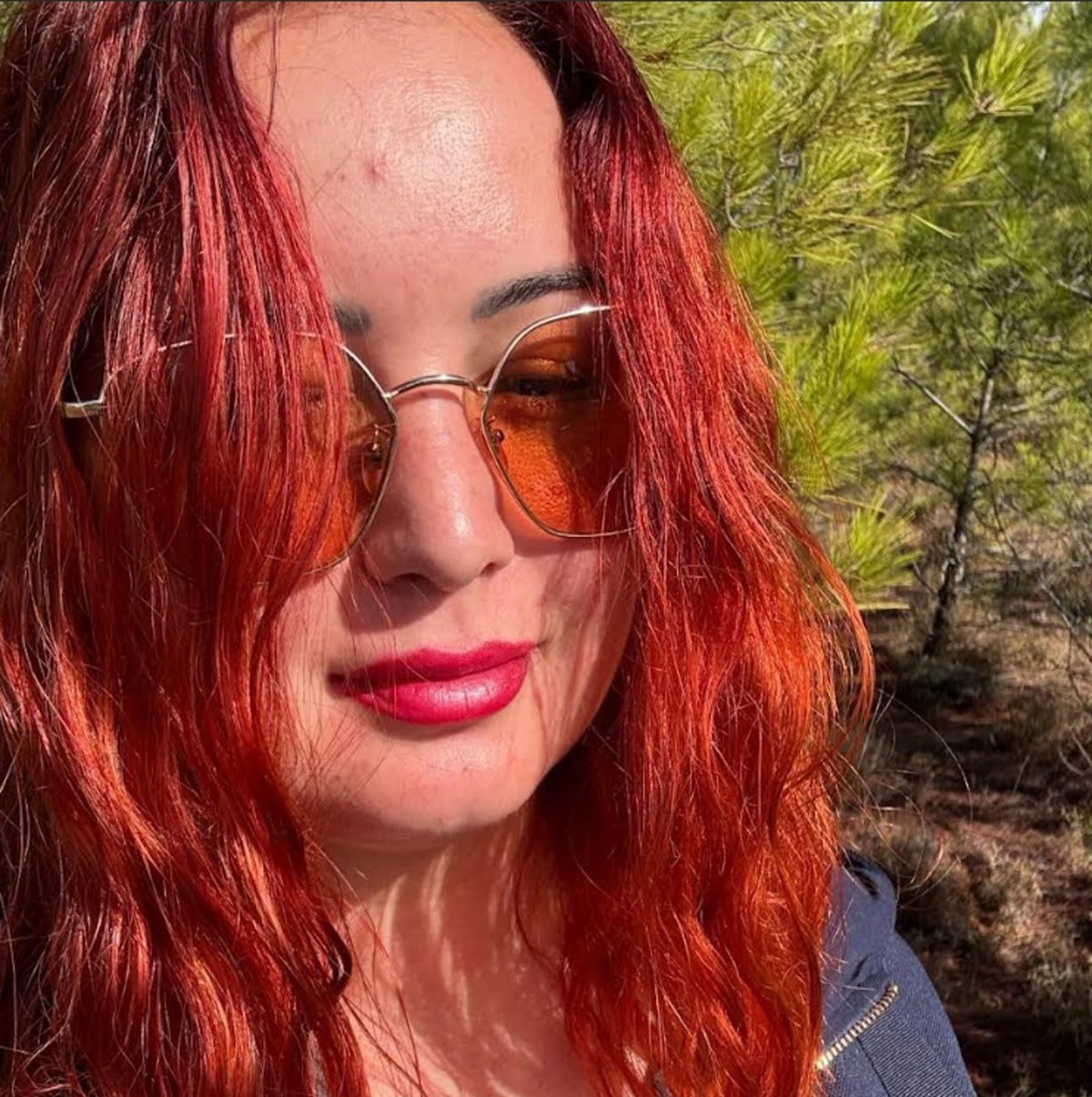 Motosikletiyle kaza yapan Merve Sönmez'den acı haber geldi