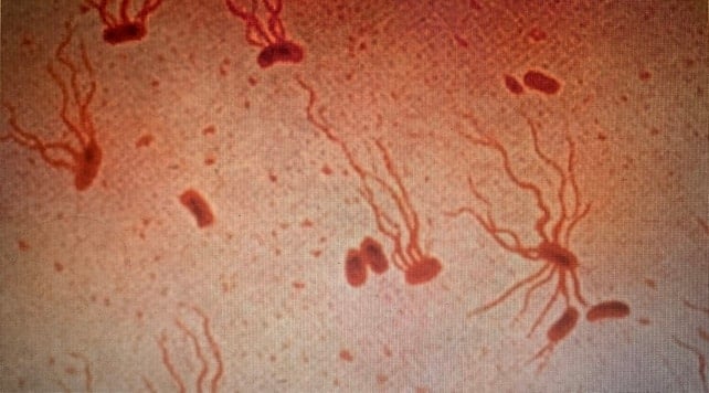 Bir tek antibiyotik kaldı, o da dirençli hale gelirse büyük kriz kapıda