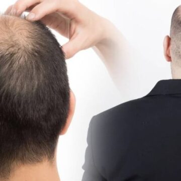 Bu içecek kafada bir tel saç bırakmıyor: Lıkır lıkır içenler yandı