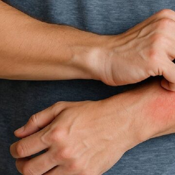 Durduk yere vücudu kaşınanlar yandı: Tehlike büyük