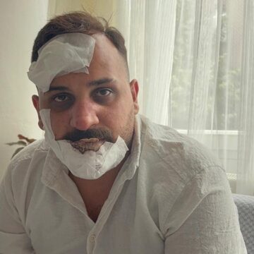 Eski sözlüye, polislerden öldüresiye dayak: ‘Sülaleni öldürürüz’