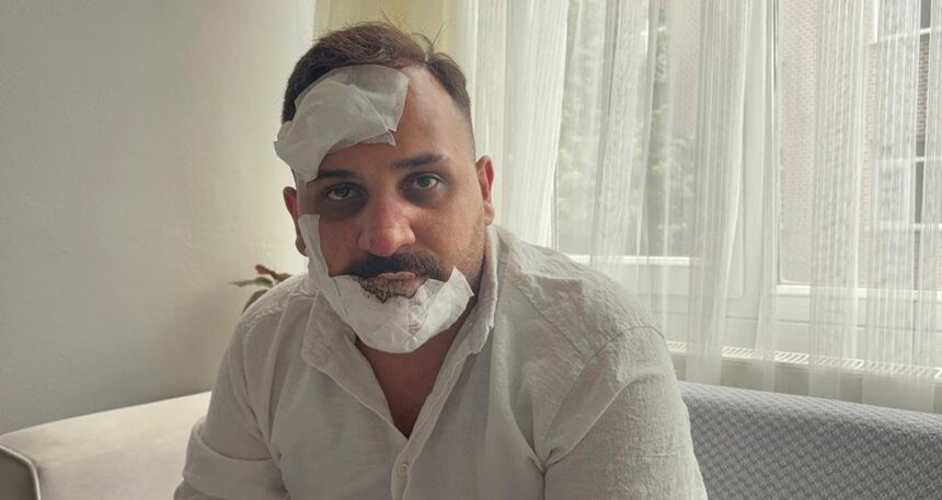Eski sözlüye, polislerden öldüresiye dayak: ‘Sülaleni öldürürüz’