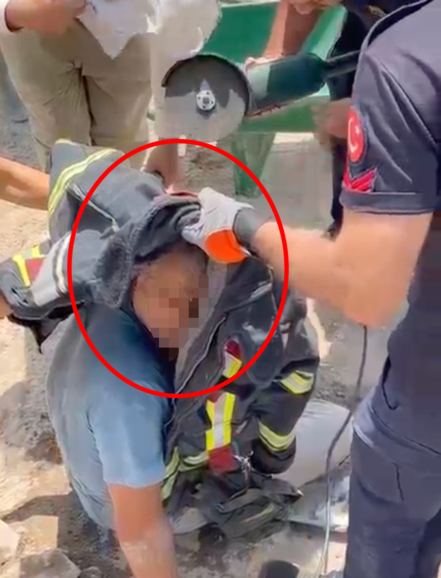 Kazı alanında korkutan kazada işçinin başına demir saplandı