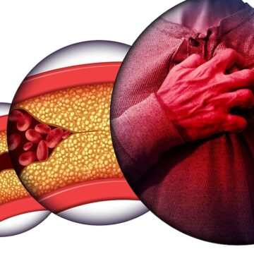 Kolesterol: Düşman mı, denge mi?