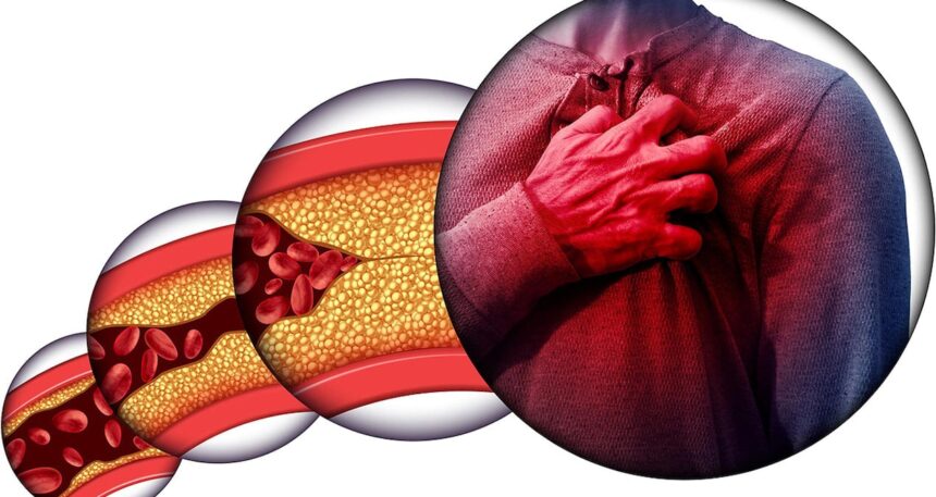 kolesterol-dusman-mi-denge-mi-Hz7XFqaF.jpg Kolesterol: Düşman mı, denge mi?