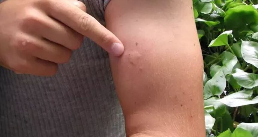 Sivrisineklerde virüs alarmı: 10 kişiden biri ölüyor
