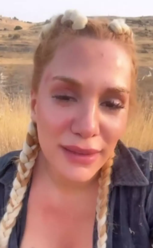 Survivor Almeda ölümden döndü! Takipçilerinden yardım istedi