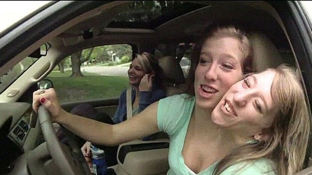 Yapışık ikizlerden bebekli fotoğraf: Tıp dünyası şokta