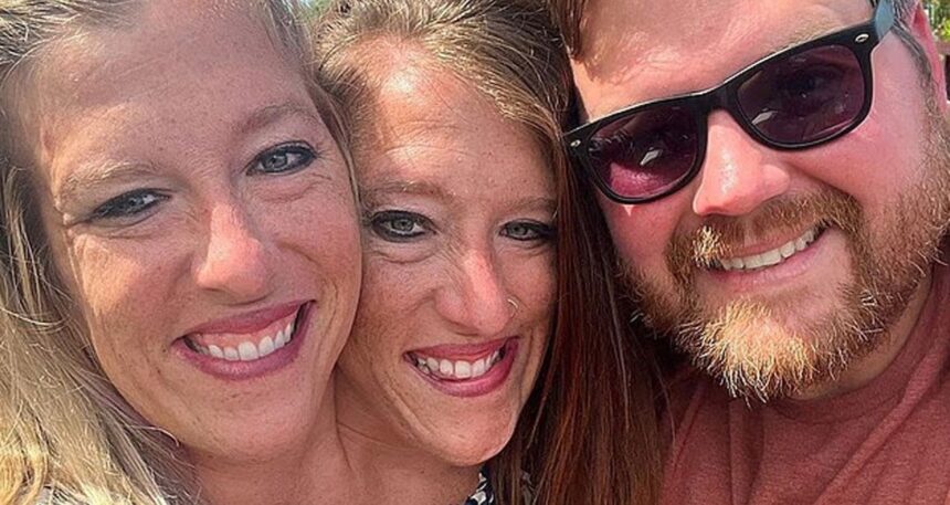 Yapışık ikizlerden bebekli fotoğraf: Tıp dünyası şokta