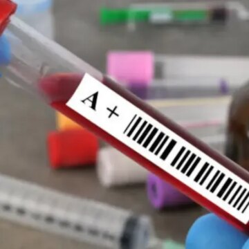 a-rh-kan-grubuna-sahip-olanlari-ilgilendiriyor-yorgun-hissetmenizin-sebebi-ve-caresi-buymus-Z5U4E5uW.jpg A Rh+ kan grubuna sahip olanları ilgilendiriyor: Yorgun hissetmenizin sebebi ve çaresi buymuş