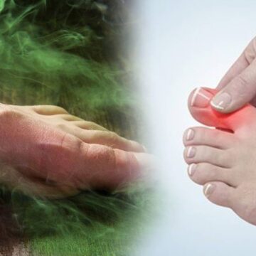 Ayak mantarının kökünü kurutuyor: 2 malzeme yetiyor, kokudan eser kalmıyor