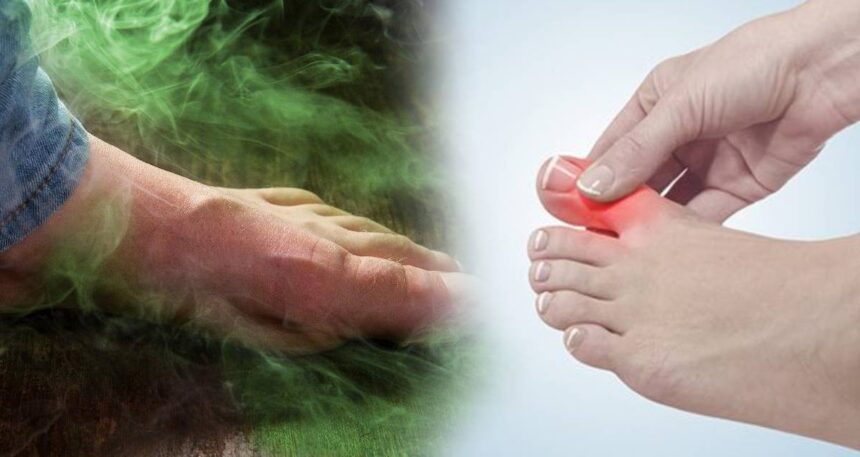 Ayak mantarının kökünü kurutuyor: 2 malzeme yetiyor, kokudan eser kalmıyor