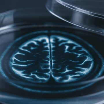 bilinc-kazanan-mini-beyinlerde-etik-tartismasi-basladi-bkETi2h9.jpg Bilinç kazanan ‘mini beyinlerde’ etik tartışması başladı