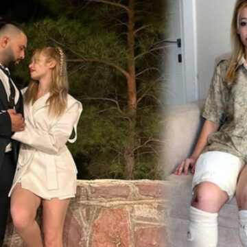Evlilik yıl dönümünde bacaklarını kaybetti