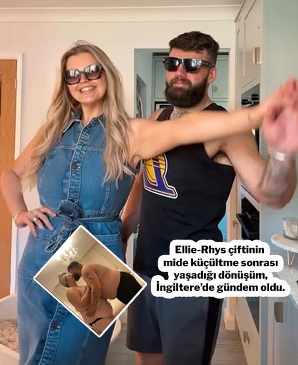 Göğüs mide, saç. Hepsi İstanbul’da