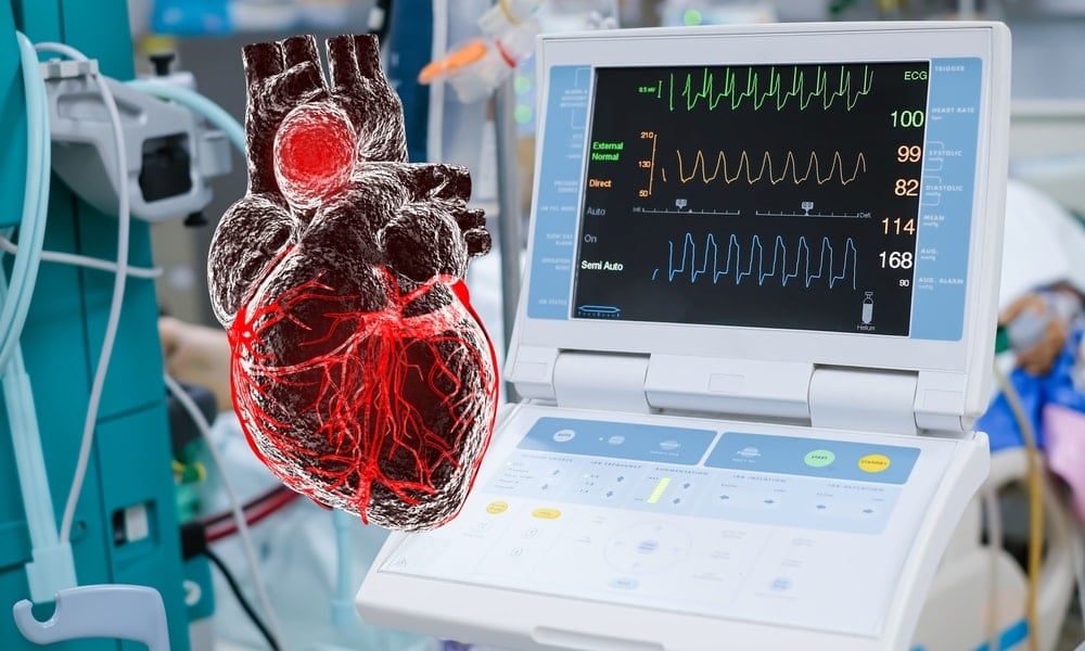 Böbrek naklinde beklemeyi bitirecek gelişme! Bilim insanları organın kan grubunu değiştirdi