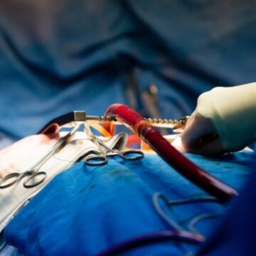 Böbrek naklinde beklemeyi bitirecek gelişme! Bilim insanları organın kan grubunu değiştirdi